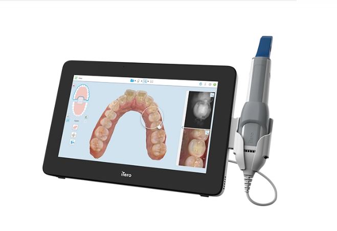 iTero Dental 3D intraoral scanner